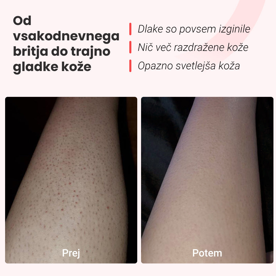 Fotoepilator IPL Hilda
